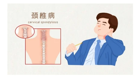 Konsènan lensomni? Èske w te konsidere kòz kolòn vètebral la nan matris la?